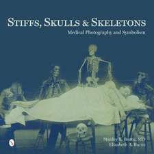 Stiffs, Skulls & Skeletons: Medical Photography and Symbolism