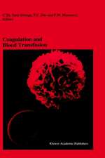 Coagulation and Blood Transfusion: Proceedings of the Fifteenth Annual Symposium on Blood Transfusion, Groningen 1990, organized by the Red Cross Blood Bank Groningen-Drenthe