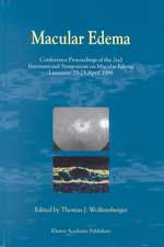Macular Edema