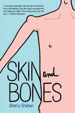 Skin and Bones