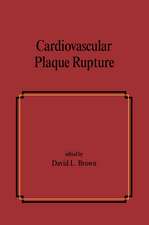 Cardiovascular Plaque Rupture