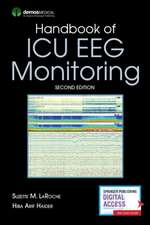 Handbook of ICU Eeg Monitoring, Second Edition