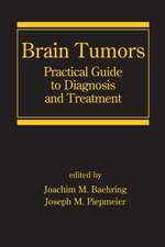 Brain Tumors: Practical Guide to Diagnosis and Treatment