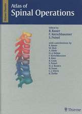 Atlas of Spinal Operations