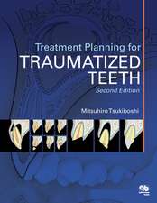 Treatment Planning for Traumatized Teeth