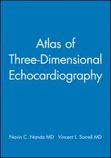 Atlas of Three–Dimensional Echocardiography