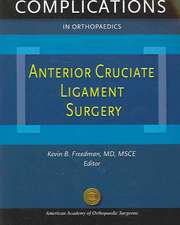 Complications in Orthopaedics: Anterior Cruciate Ligament Surgery