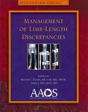 Management of Limb-Length Discrepancies