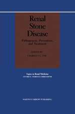 Renal Stone Disease: Pathogenesis, Prevention, and Treatment