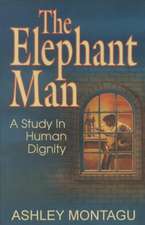 The Elephant Man: A Study in Human Dignity