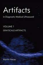 Artifacts in Diagnostic Medical Ultrasound