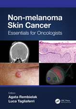 Non-melanoma Skin Cancer: Essentials for Oncologists