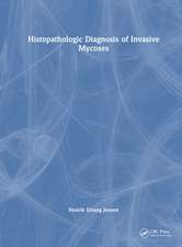 Histopathologic Diagnosis of Invasive Mycoses