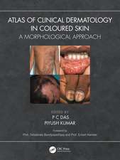 Atlas of Clinical Dermatology in Coloured Skin