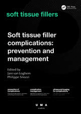 Soft Tissue Filler Complications