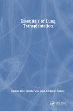 Essentials of Lung Transplantation