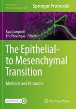 The Epithelial-to Mesenchymal Transition: Methods and Protocols