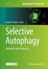 Selective Autophagy: Methods and Protocols