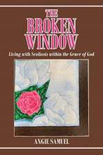 The Broken Window