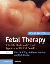 Fetal Therapy: Scientific Basis and Critical Appraisal of Clinical Benefits