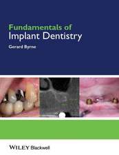 Fundamentals of Implant Dentistry