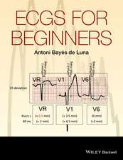 ECGs for Beginners