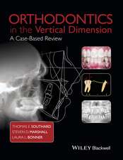 Orthodontics in the Vertical Dimension – A Case–Based Review