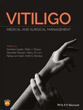 Vitiligo – Medical and Surgical Management