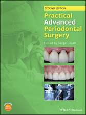 Practical Advanced Periodontal Surgery, 2nd 2nd Edition