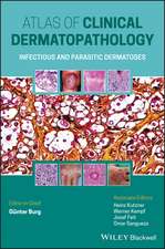 Atlas of Clinical Dermatopathology – Infectious and Parasitic Dermatoses