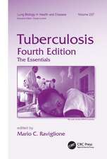 Tuberculosis: The Essentials, Fourth Edition