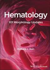 Hematology – 101 Morphology Updates