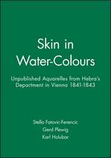 Skin in Water–Colours – Aquarelles from Hebra′s Department in Vienna 1840–1843