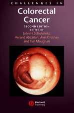 Challenges in Colorectal Cancer 2e