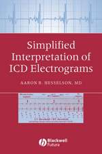 Simplified Interpretation Electrograms