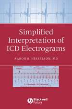 Simplified Interpretation of ICD Electrograms