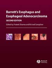 Barrett′s Esophagus and Esophageal Adenocarcinoma 2e