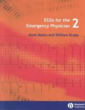 ECGs for the Emergency Physician 2e