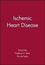 Ischemic Heart Disease