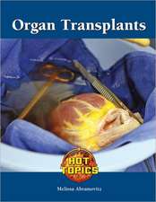 Organ Transplants