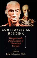 Controversial Bodies – Thoughts on the Public Display of Plastinated Corpses