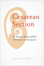 Cesarean Section – An American History of Risk, Technology, and Consequence