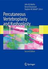 Percutaneous Vertebroplasty and Kyphoplasty