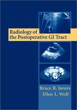 Radiology of the Postoperative GI Tract