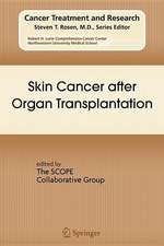 Skin Cancer after Organ Transplantation