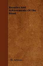 Beauties And Achievements Of The Blind