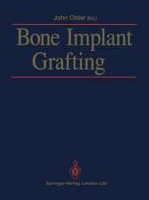 Bone Implant Grafting