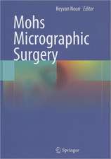 Mohs Micrographic Surgery