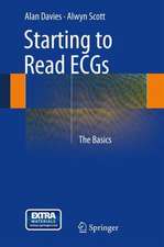 Starting to Read ECGs: The Basics