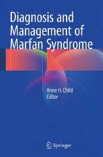 Diagnosis and Management of Marfan Syndrome